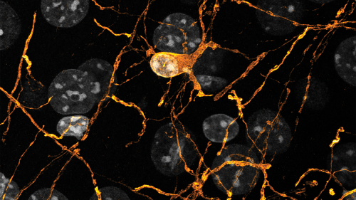 image from Robert Hill's lab
