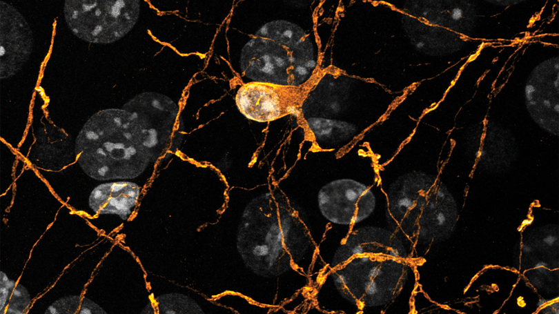 image from Robert Hill's lab