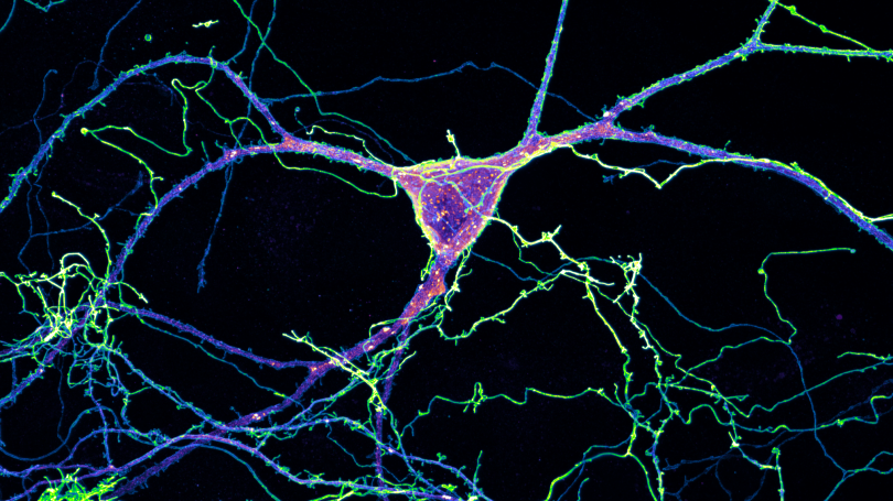 neuron 3