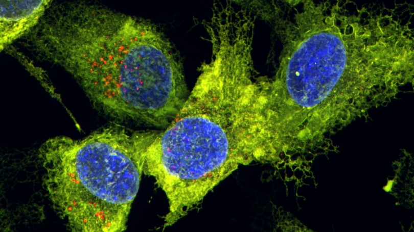cancer cells_2