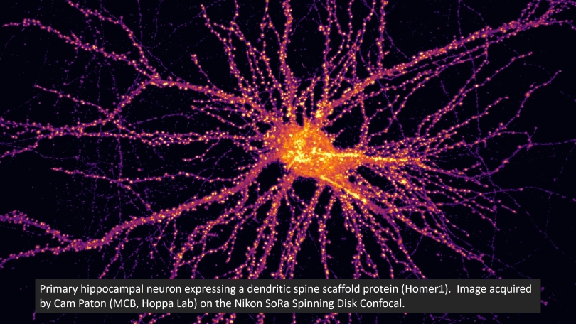 neuron 2
